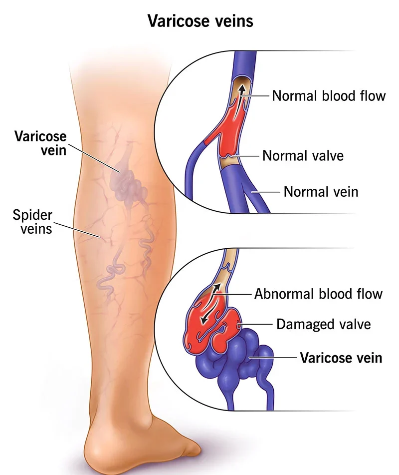 No.1 & Best Diode laser procedures Hospital In Jalandhar 2023