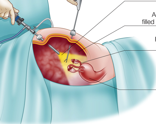 Best And No.1 Laparoscopic Surgery Hospital In Jalandhar 2023