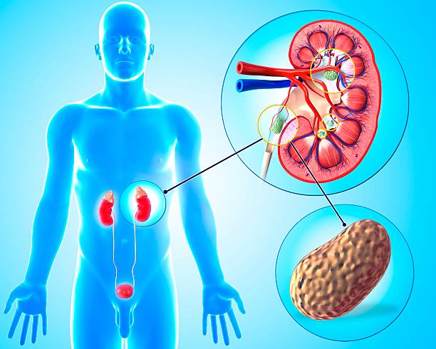BEST KIDNEY STONE TREATMENT IN JALANDHAR 2023