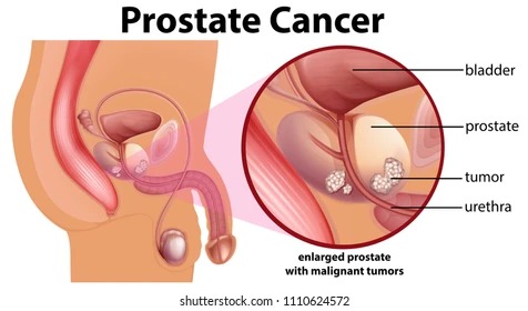 BEST PROSTATE TREATMENT IN JALANDHAR 2023