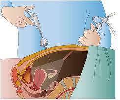 BEST LAPROSCOPIC TREATMENT IN JALANDHAR in 2023