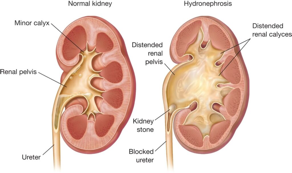BEST LAPROSCOPIC TREATMENT IN JALANDHAR 2023