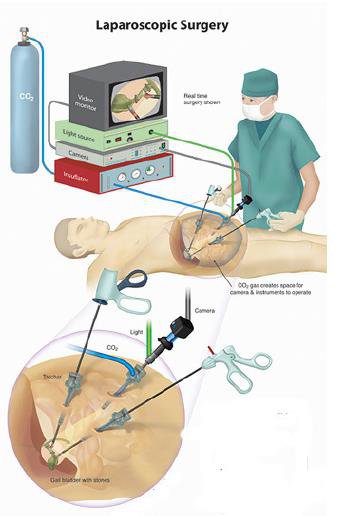 BEST LAPROSCOPIC TREATMENT IN JALANDHAR 2023