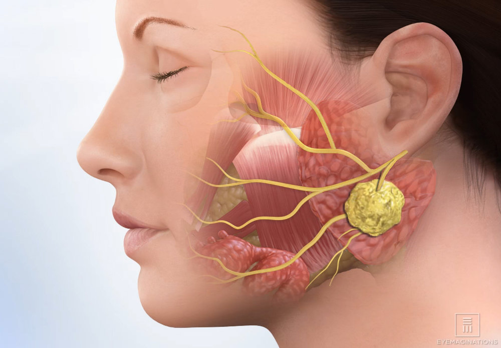 BEST THYROID & PAROTID SURGERY HOSPITAL