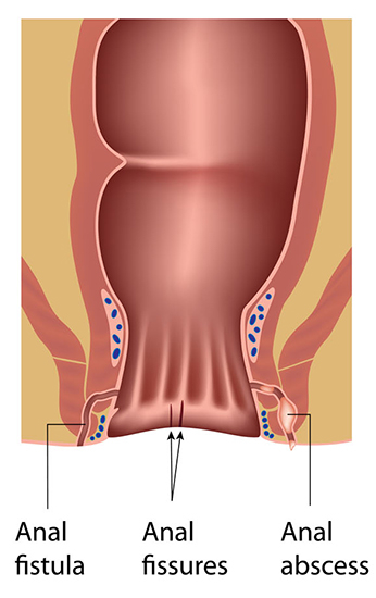 No.1 & Best Diode laser procedures Hospital In Jalandhar 2023
