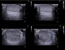 No.1 & Best Radiology Treatment Hospital In Jalandhar 2023