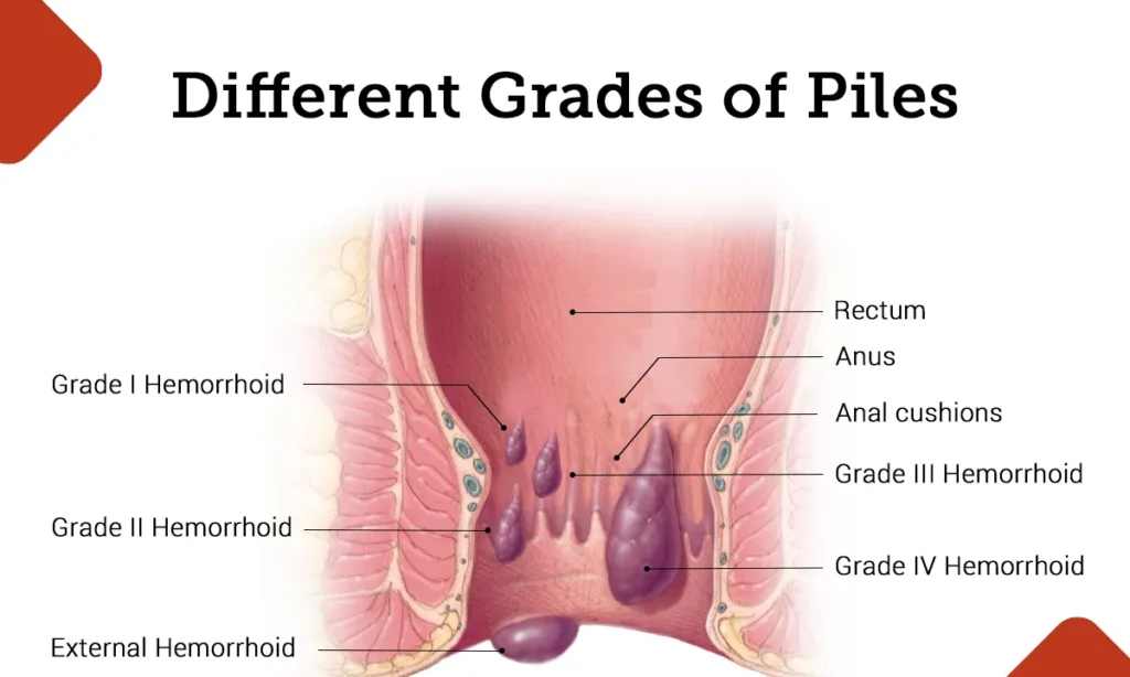 No.1 & Best Diode laser procedures Hospital In Jalandhar 2023